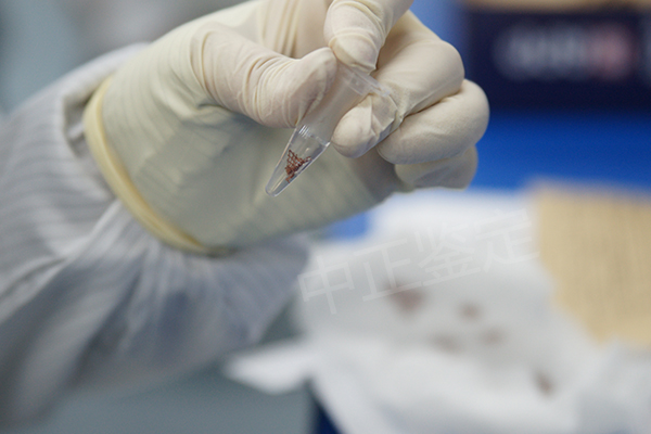 浙江医院做亲子鉴定准确性高吗,医院办理DNA鉴定样品有些什么